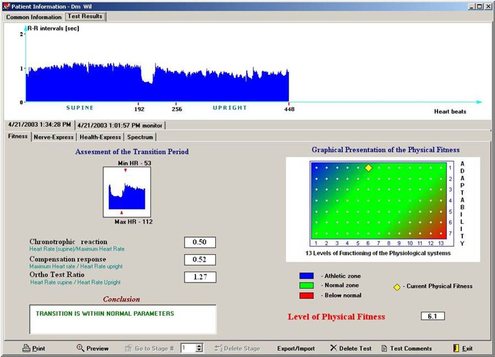 Heart Rate Variability rhythmography chart