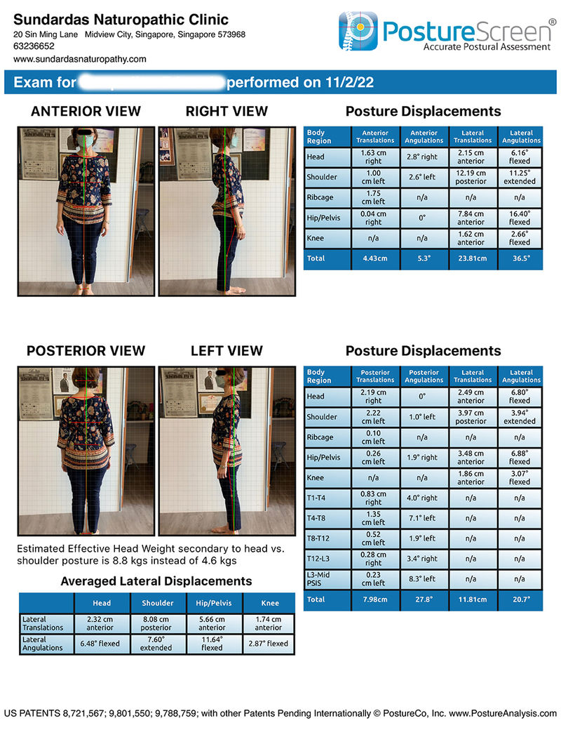 Posture Screen postural assessment visual