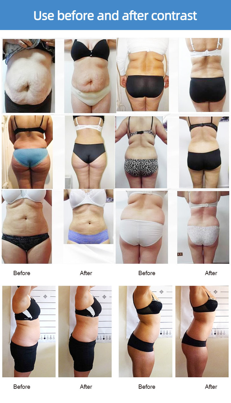 MaxLipo Light device and treatment pads
